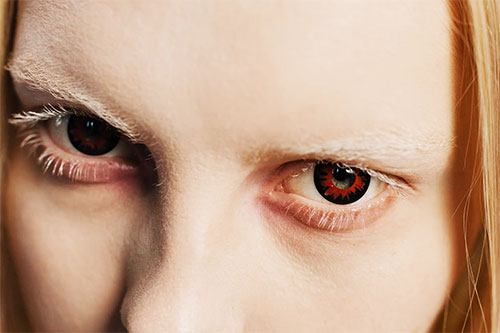 vampirisation, quand l'ombre aneantit la lumiere HPI